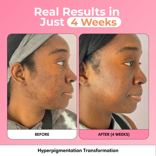 Glass Skin Kit + FREE Glow Serum | Subscription Offer