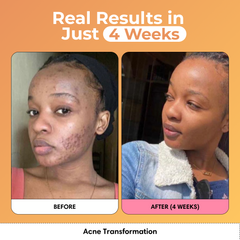 Glass Skin Kit + FREE Glow Serum | Subscription Offer