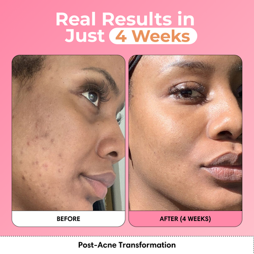 Glass Skin Kit + FREE Glow Serum | Subscription Offer