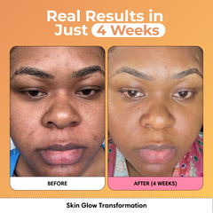 Glass Skin Kit + FREE Glow Serum | Subscription Offer