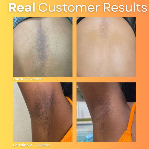 Glow Up Bundle - 3 Month Supply (save $106)