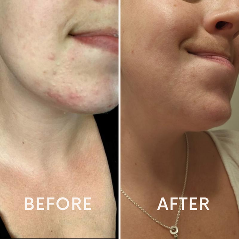 It's Pore-fect Wash