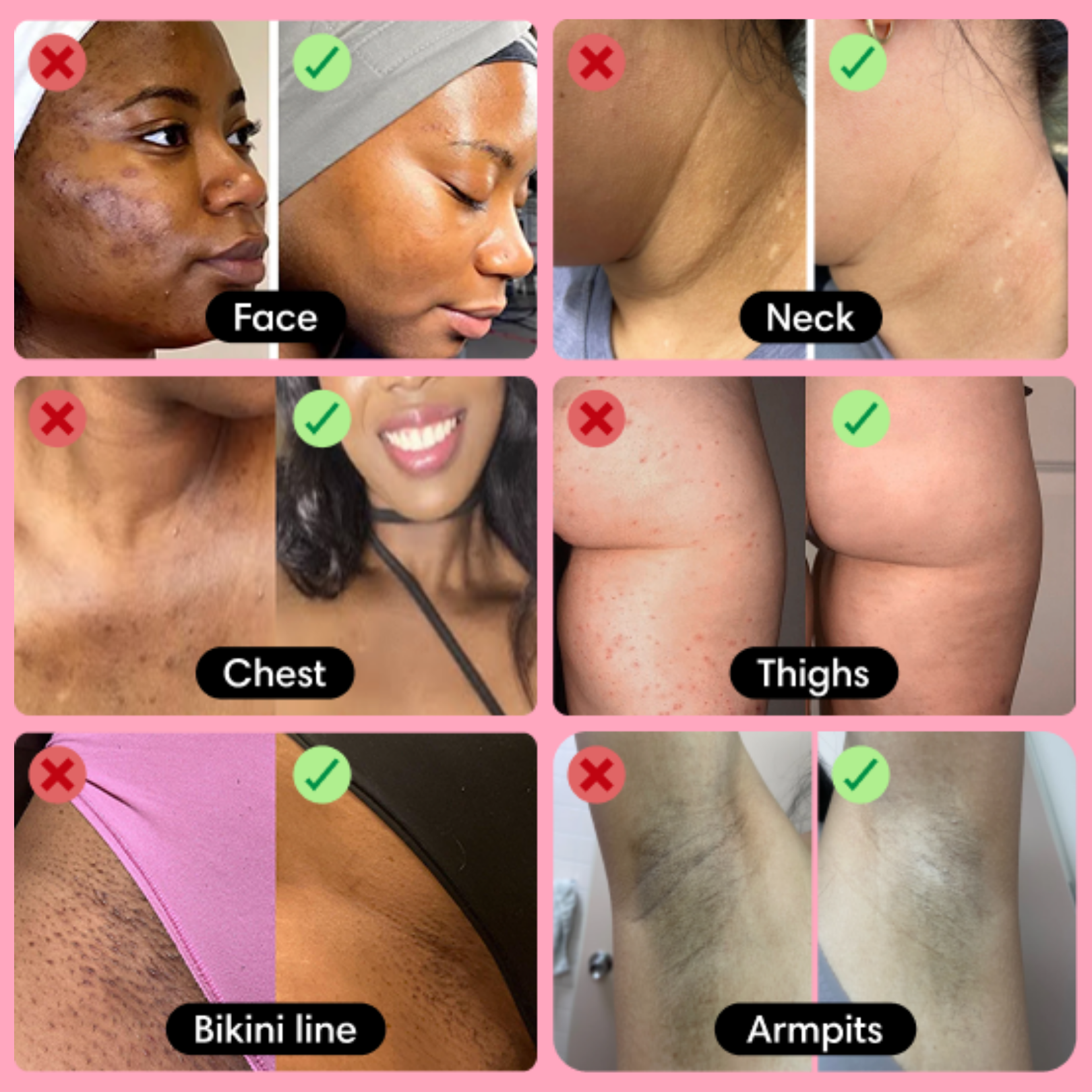 Glow Up Gel - Turmeric & Kojic Acid