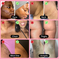 Glow Up Gel - Turmeric & Kojic Acid