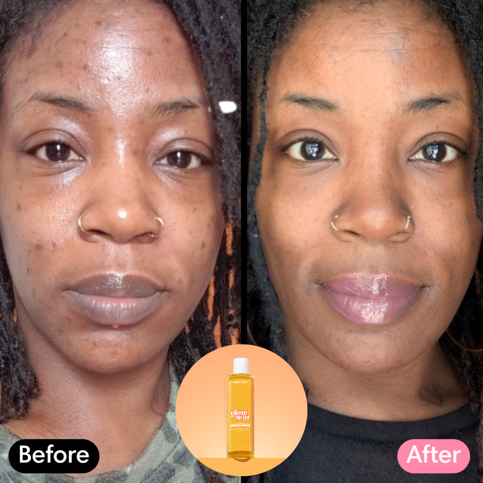 Glow Up Gel - Turmeric & Kojic Acid