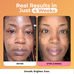 VIRAL Turmeric & Kojic Acid Glow Wash