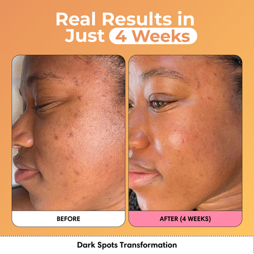 Glass Skin Kit + FREE Glow Serum | Subscription Offer