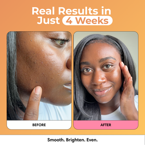 Brightening Duo – Glow Bubble Mask & Wash for Dark Spots