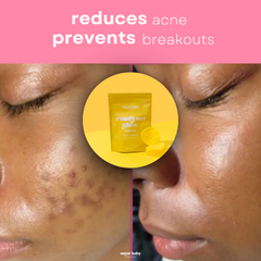 < Glass Skin Kit + FREE Glow Serum (100% OFF)