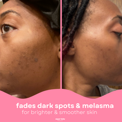 < Glass Skin Kit + FREE Glow Serum (100% OFF)