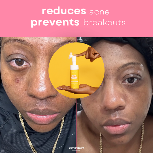 Turmeric & Kojic Acid Glow Wash