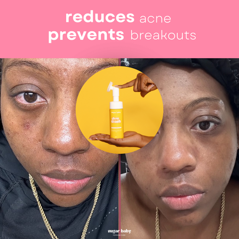 Glow Wash + FREE Pore Wash